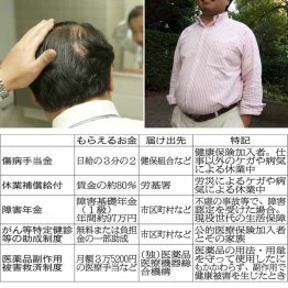 薄毛にも補助が出る場合も…（Ｃ）日刊ゲンダイ