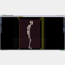最新エコーで軟部組織の軟らかさをカラー化する（提供写真）