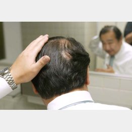 頭髪がさびしくなったら…（Ｃ）日刊ゲンダイ