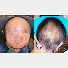 麹水を1日5cc毎日6カ月間ふりかけた結果（右）／（提供写真）