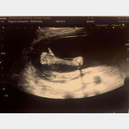 良い兆しかも！？（ツイッターから）