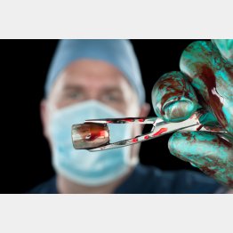 写真はイメージ（Ｃ）joebelanger／iStock