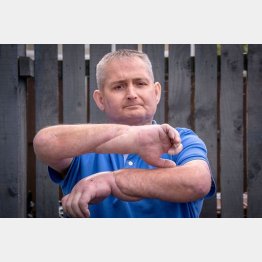 12時間をかけた手術だった（スティーブン・ギャラガーさん）／（インスタグラムから）