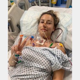 9時間に及ぶ手術は無事成功しました（シャーロット・ウェブスターさん）／（インスタグラムから）