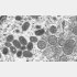 サル痘ウイルス（ＣＤＣ提供・共同）