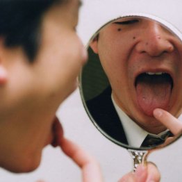 舌がんなど頭頚部がんが対象（Ｃ）日刊ゲンダイ