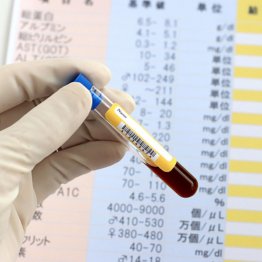 採血の検査でも…