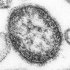 麻疹ウイルスの電子顕微鏡写真（提供）米疾病対策センター